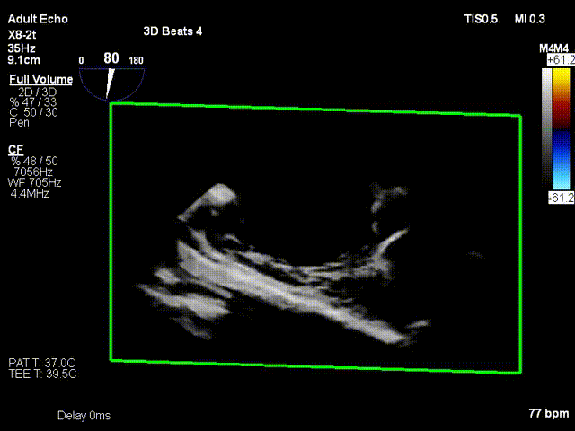 3.gif