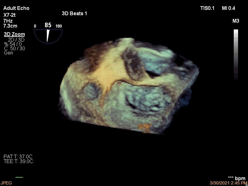 11.gif