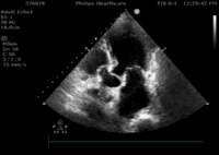 ２.gif