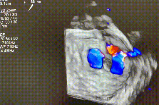 222.gif