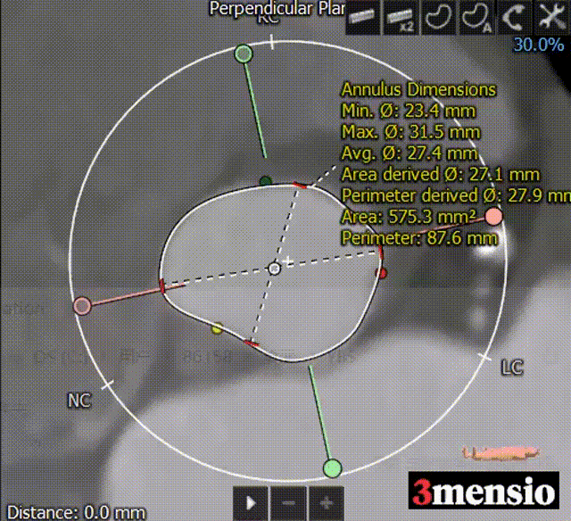11.gif