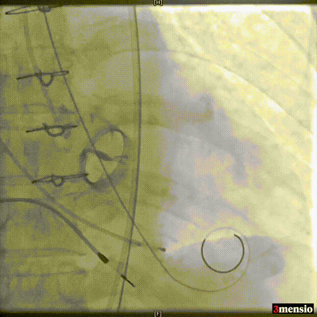 11.gif