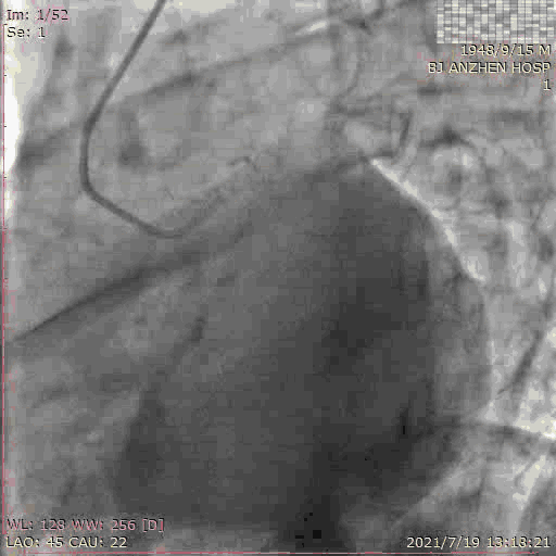 11.gif