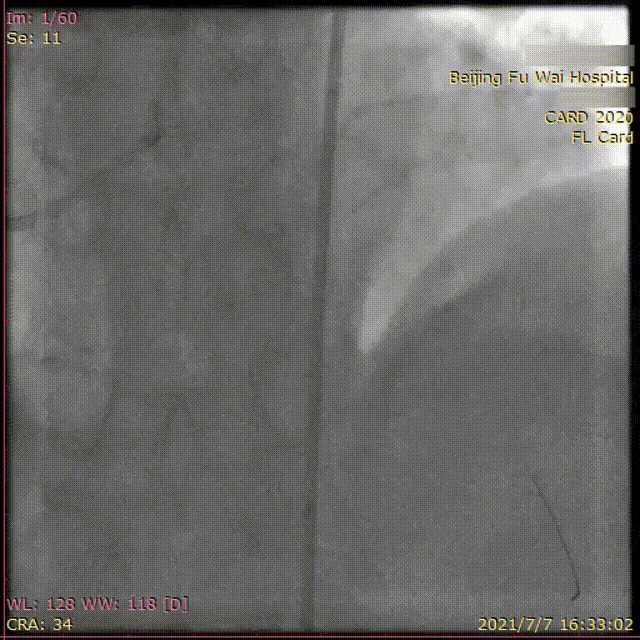 11.gif