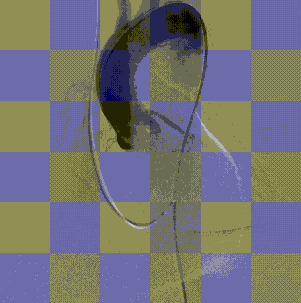 33.gif
