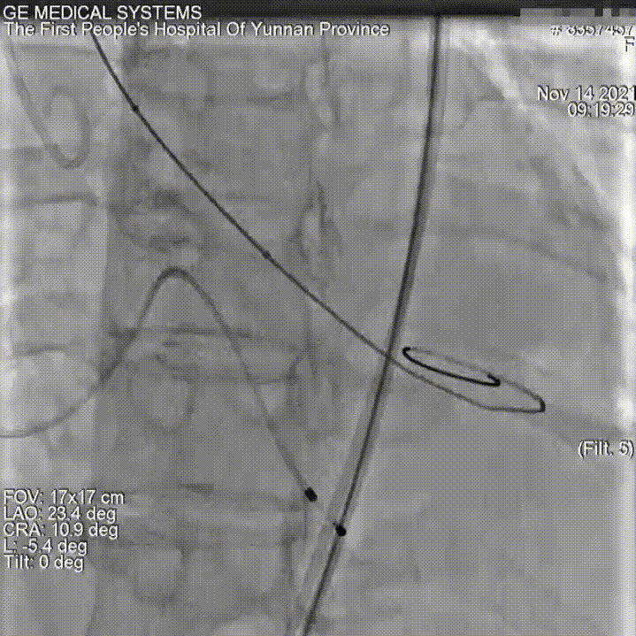 微信图片_20211122113406.gif