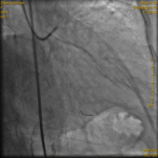 9.gif
