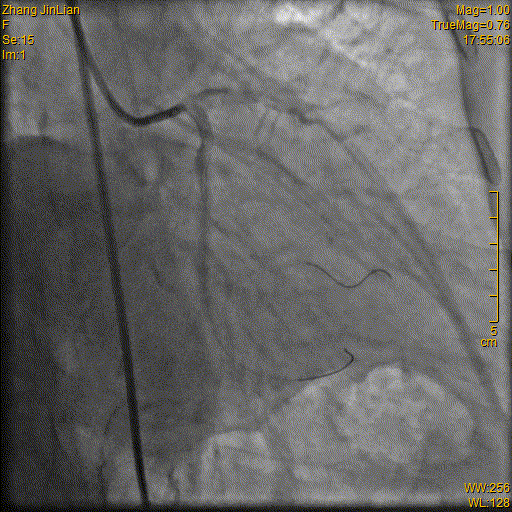10.gif