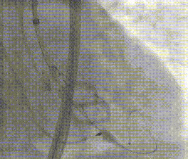 微信图片_20211129113647.gif