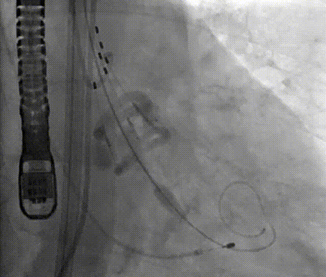 微信图片_20211129113655.gif