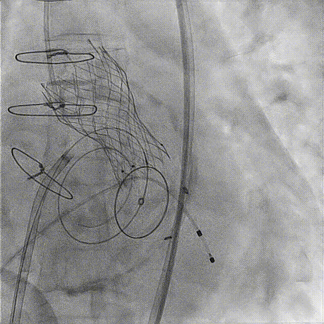 微信图片_20211203115630.gif