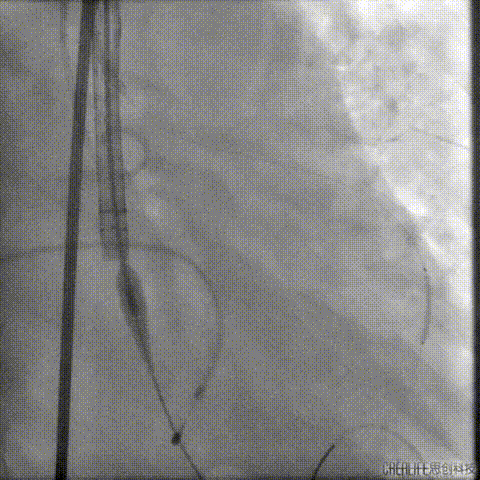 3.gif