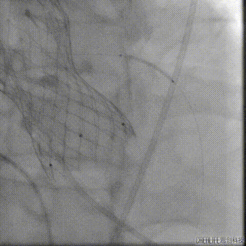 4.gif