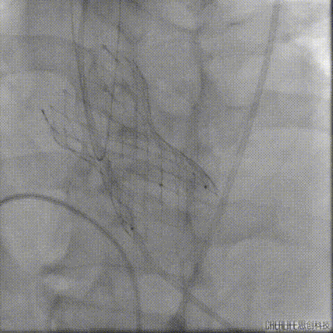 6.gif