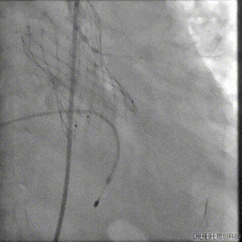 7.gif