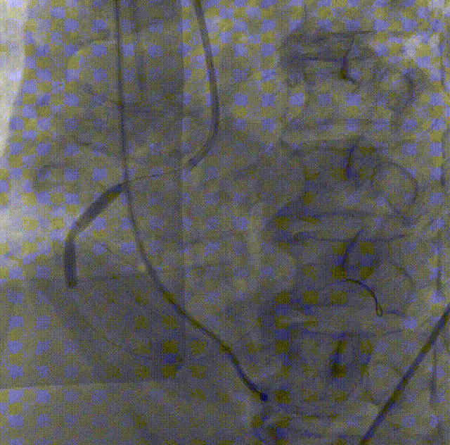 5.gif