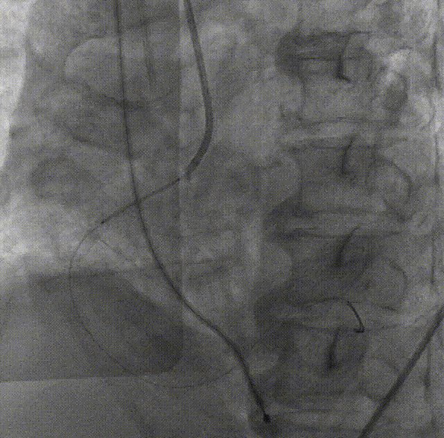 6.gif