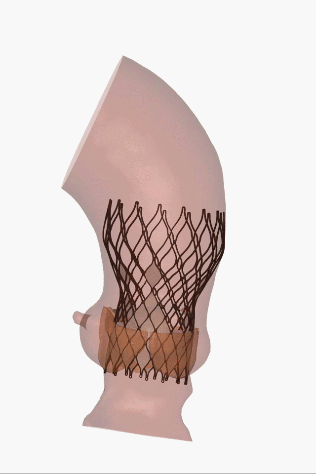 4.gif