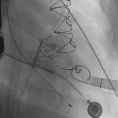 微信图片_20220104121956.gif