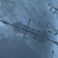 微信图片_20220104155305.gif