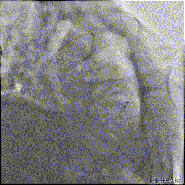 4.gif