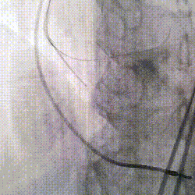 微信图片_20220128163808.gif