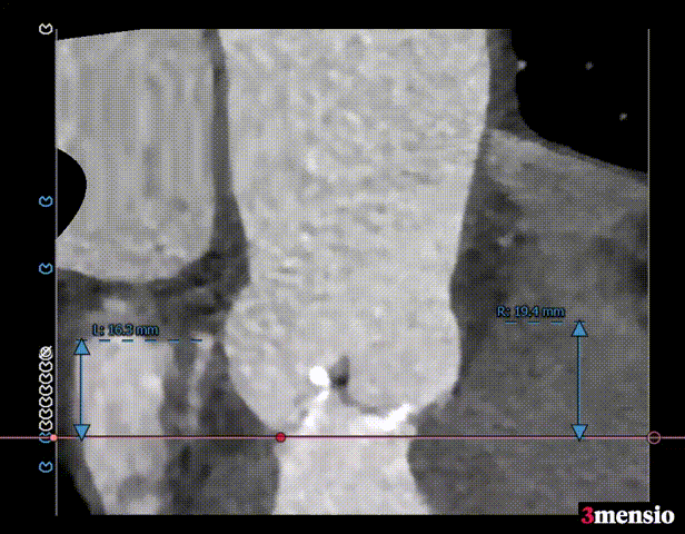 11.gif