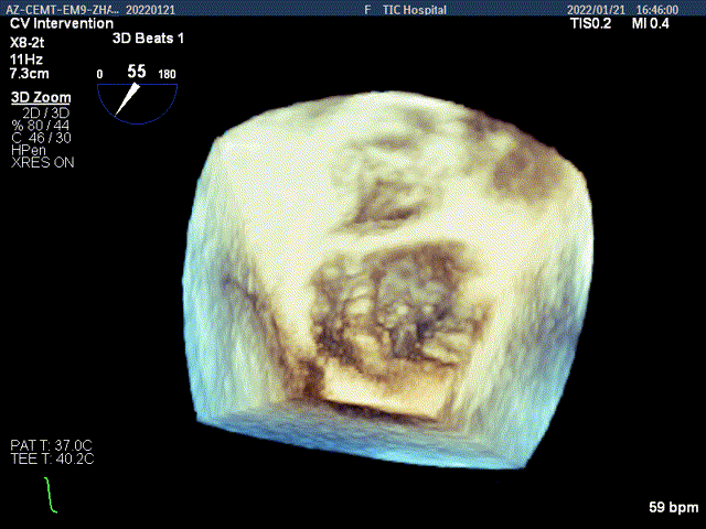 微信图片_20220131161827.gif