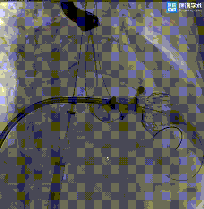 微信图片_20220131164613.gif