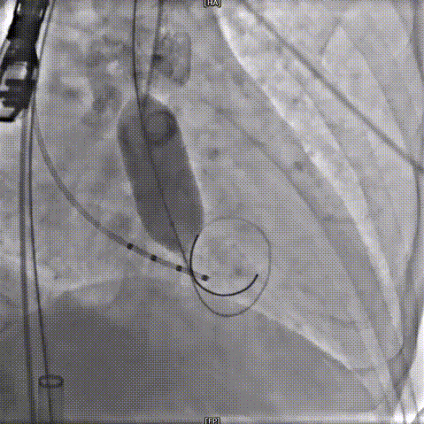 1.gif