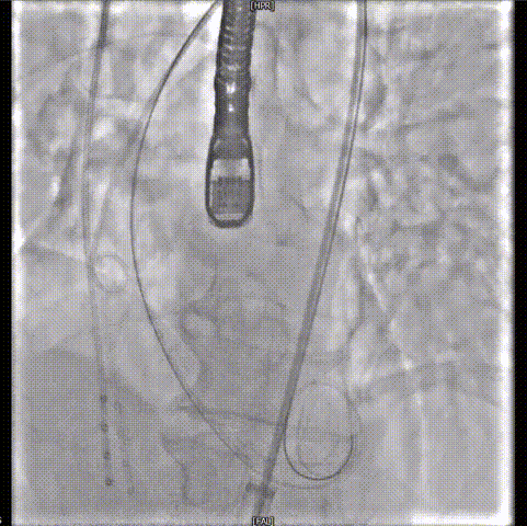 2.gif