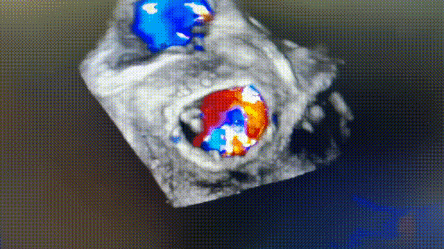 11.gif