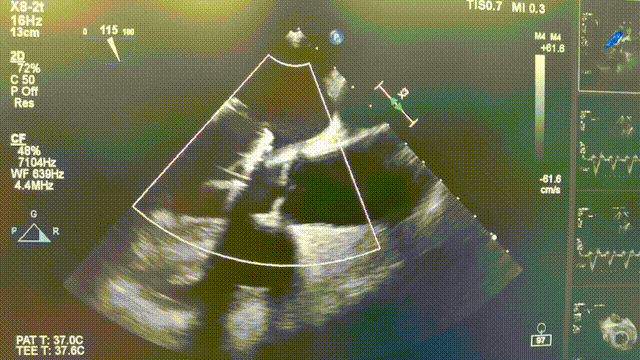 5.gif