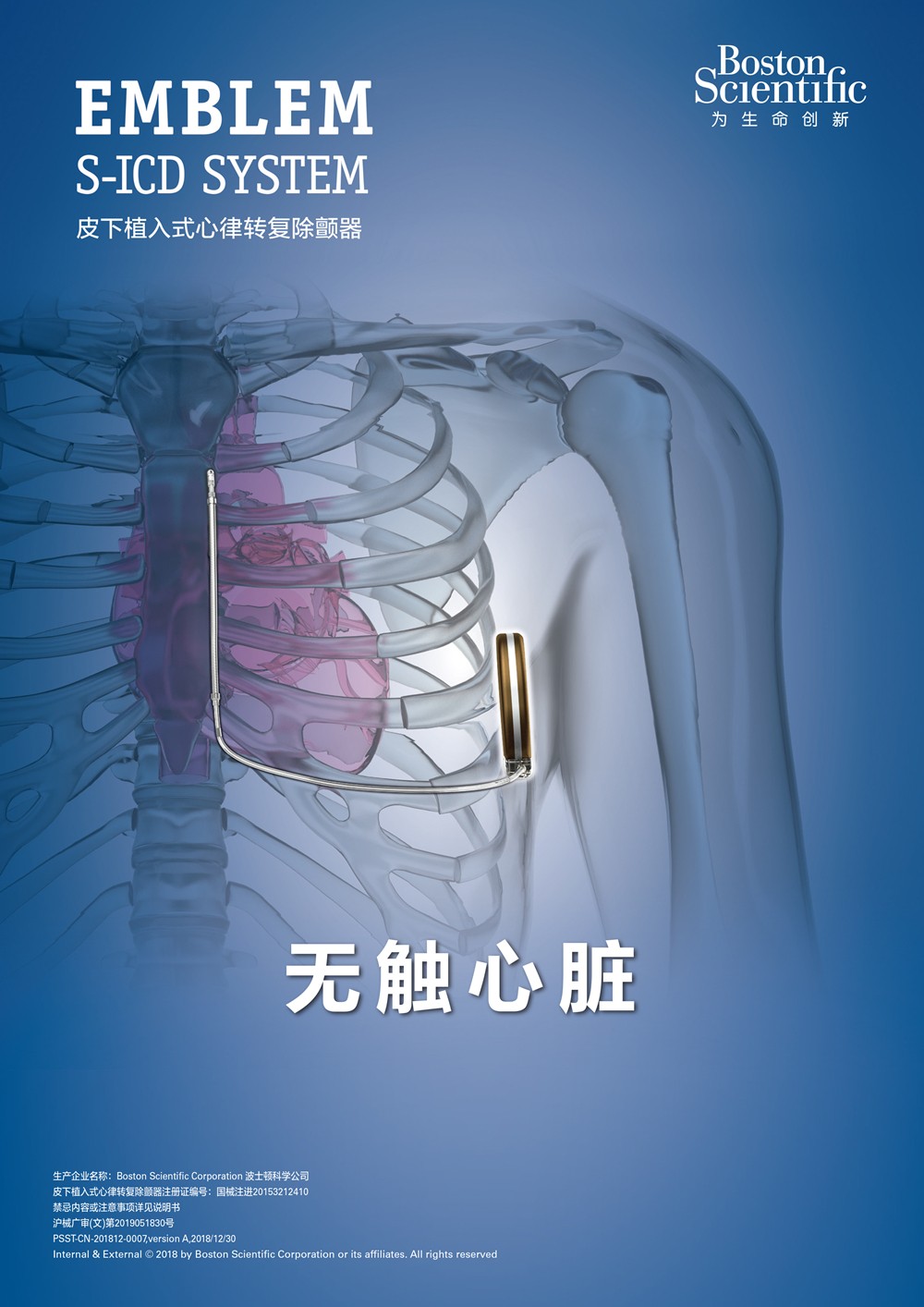 S-ICD.jpg