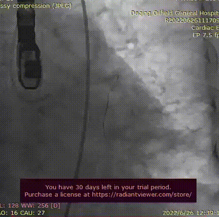 1.gif